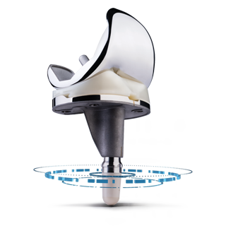 Zimmer Biomet Persona IQ® The Smart Knee®